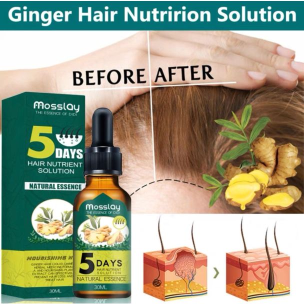 سيروم انبات وتقوية الشعر EELHOE